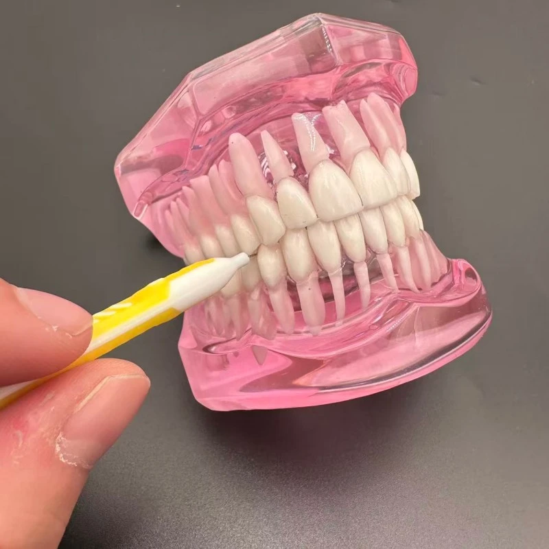 Overmolded Type I Interdental Brush